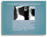 X-Ray Testimonial Mini Posters (Blue #1)