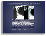 X-Ray Testimonial Mini Posters (Blue #3)