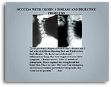 X-Ray Testimonial Mini Posters (Grey #2)