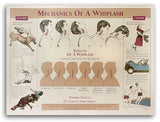 Mechanics of a Whiplash Poster