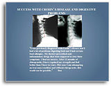 X-Ray Testimonial Mini Posters (Blue #2)