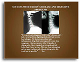 X-Ray Testimonial Mini Posters (Brown #2)