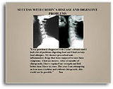 X-Ray Testimonial Mini Posters (Tan #1)
