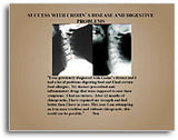 X-Ray Testimonial Mini Posters (Tan #2)